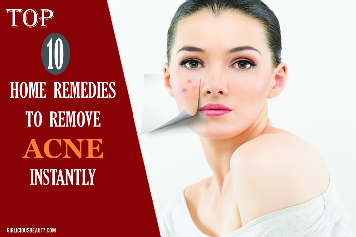 How To Remove Acne Instantly – Top 10  Home Remedies