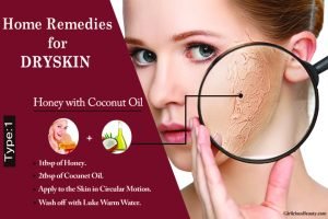 DRY SKIN