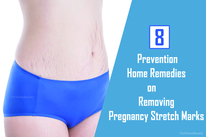 Prevention Home Remedies On Removing Pregnancy Stretch Marks