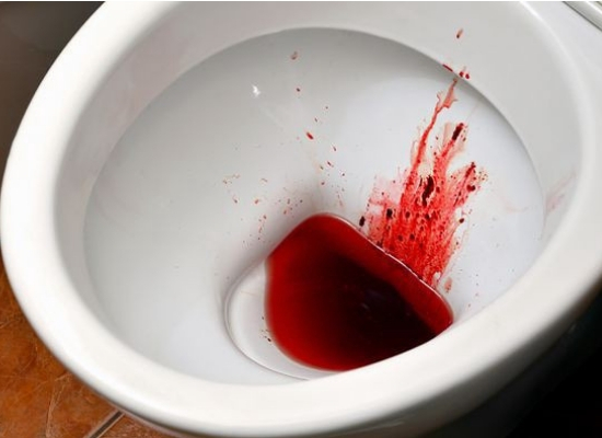 Blood in urine 