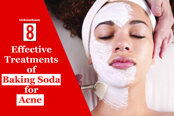 8 Interesting Ways Of Using Baking Soda For Treating Acne