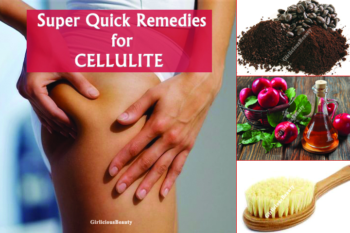Super Quick Home Remedies To get Rid Off Cellulite