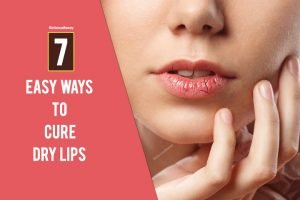Dry Lips (1)