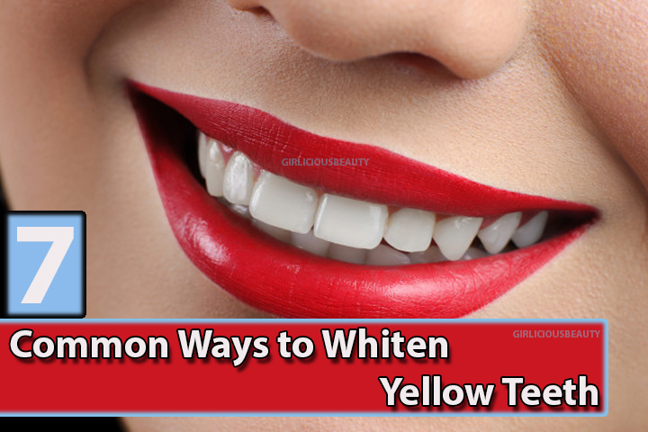 7 Common Ways To Whiten Yellow teeth – Perfect Home Remedies