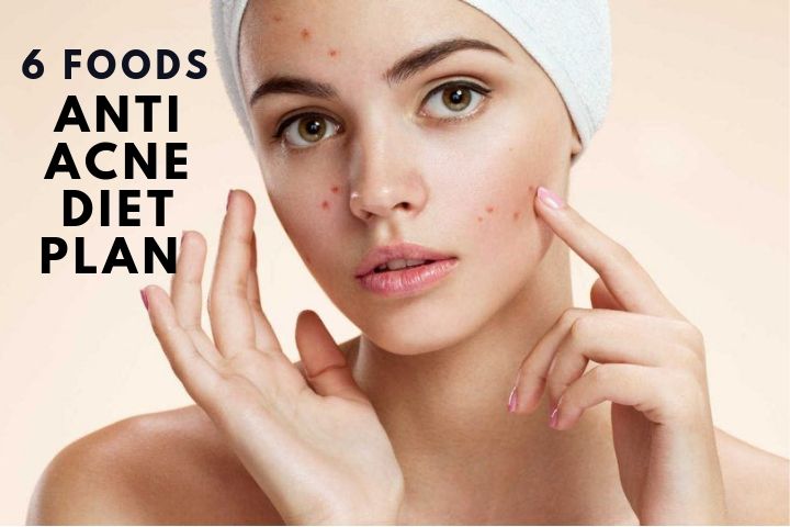 6 Anti Acne Diet Plan For Free Skin