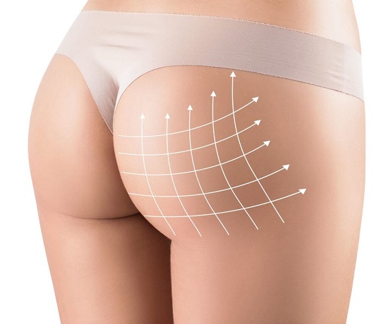Non Surgical Butt Lifts Are Here to Stay