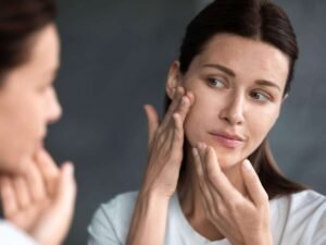 Skin Ageing