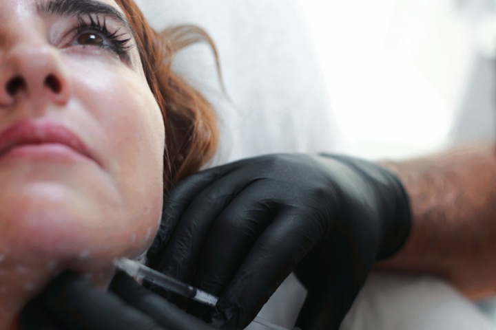 Derma Filler vs. Botox: Are they the same thing?
