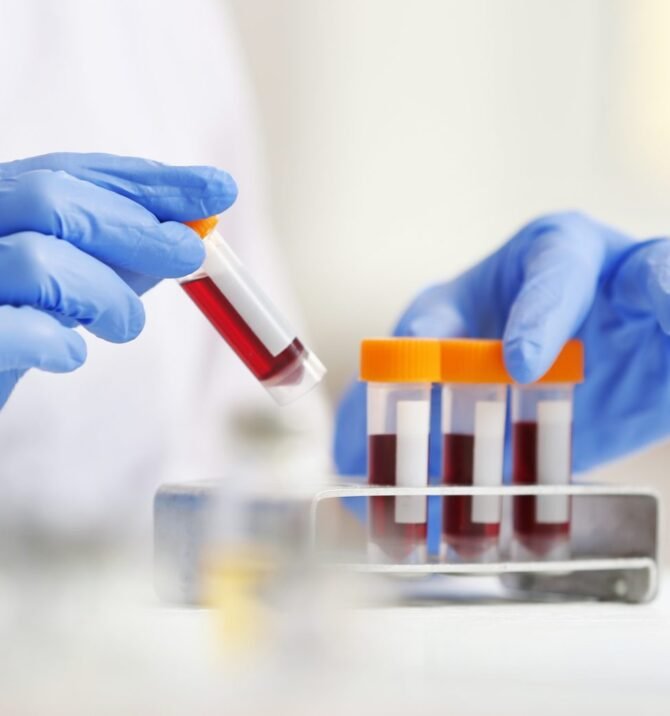 How Modern Technology Enhances CRP Test Accuracy